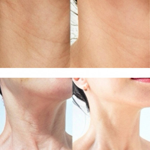 Крем для шеи  и декольте с коллагеном и пептидами MEDIPEEL Premium 3.0 Collagen Naite Thread Neck Cream