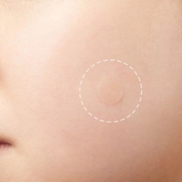 Патчи против акне и воспалений Elizavecca Witch Piggy Hell-Pore Blemish Spot Patch